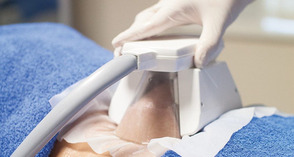 How Fat Freezing and HIFU Work Together? 2 Multiple Areas in One Session HIFU and Fat Freezing Twickenham