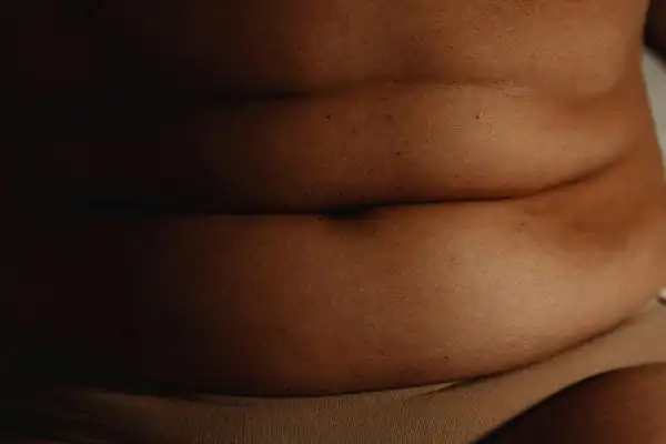 The Hidden Connection: How Stress Shapes Your Fitness and Body Composition 3 image of what stress can do on the stomach area and how Lipo 360 Twickenham can help to change your body shape.
