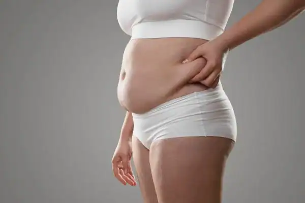 Image of stress belly Twickenham How Lipo 360 can help manage your symptoms
